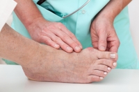 What Can Cause a Bunion to Develop?