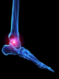 Possible Symptoms of Arthritic Feet
